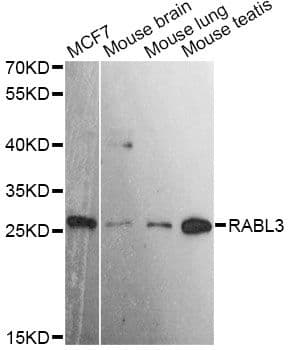 Polyclonal Rabbit anti-Human RABL3 Antibody (WB)