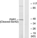 IHC-plus™ F2R / Thrombin Receptor / PAR1 Antibody (aa23-72)