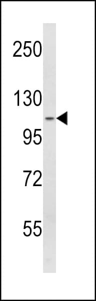 SPINK5 / LEKTI Antibody (aa188-217)