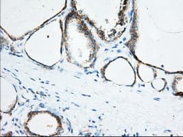 KHK / Ketohexokinase Antibody (clone OTI1D8)