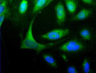 HOMER1 / Homer 1 Antibody (N-Terminus)
