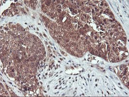HDHD1 Antibody (clone OTI3E11)