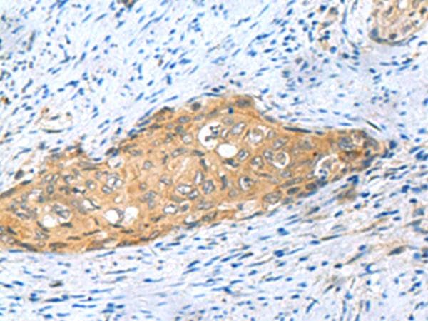 Polyclonal Rabbit anti-Human MYDGF / SF20 Antibody (IHC)