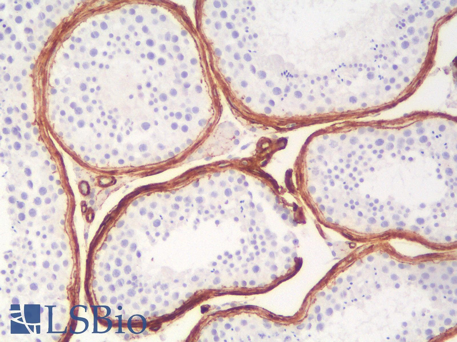 PathPlus™ Collagen IV Antibody (Concentrated)