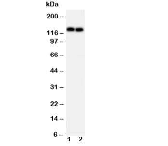 CDH2 / N Cadherin Antibody (aa701-714)