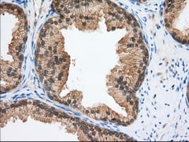 ERIC-1 / TACC3 Antibody (clone OTI1E4)