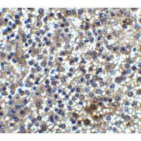 IHC-plus™ Polyclonal Rabbit anti-Human HAVCR2 / TIM-3 Antibody (IHC, IF, WB)