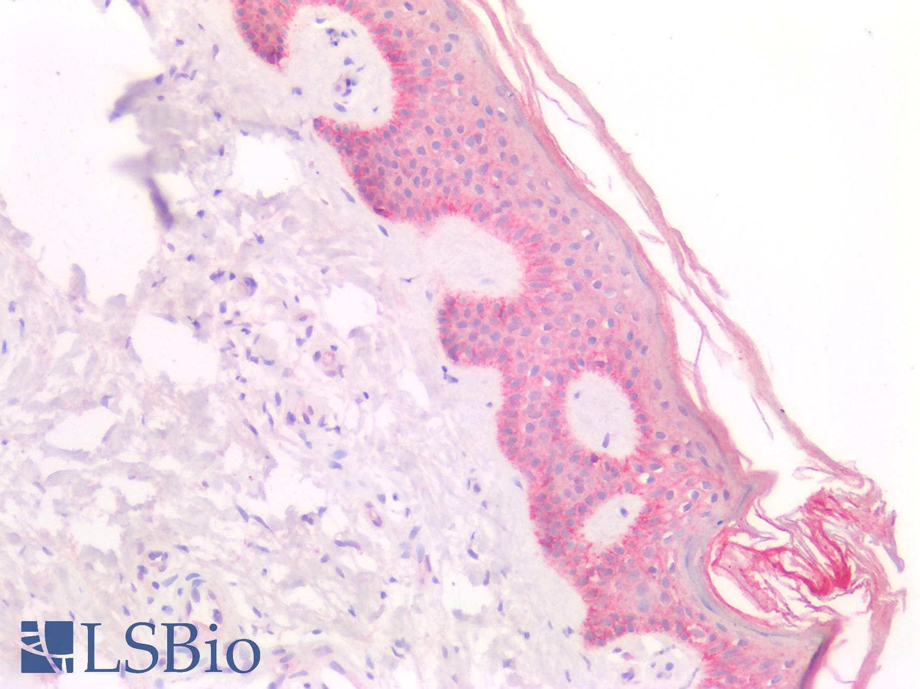 PathPlus™ CDH3 / P-Cadherin Antibody
