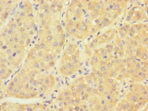 PCBD1 / PHS Antibody