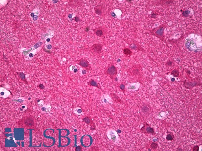 IHC-plus™ Polyclonal Rabbit anti-Human IRX3 Antibody (aa271-320, IHC)