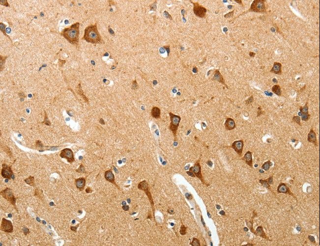 BRUCE / BIRC6 Antibody