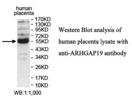 Polyclonal Rabbit anti-Human ARHGAP19 Antibody (aa2-206, WB)