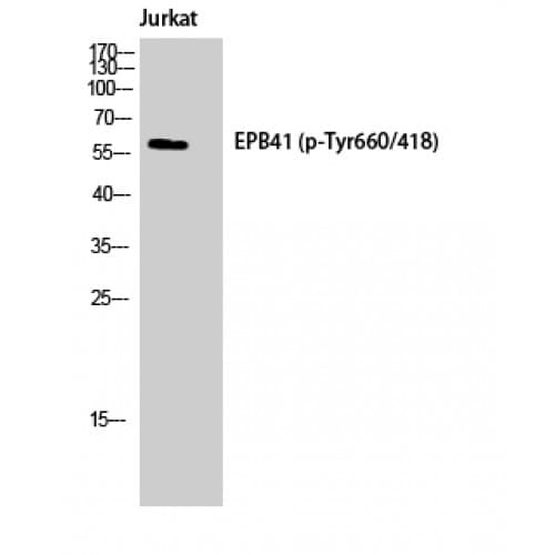 Band 4.1 / EPB41 Antibody (600-680 aa)