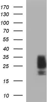 KITLG / SCF Antibody (clone OTI6E5)