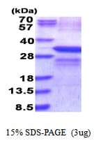 Human LOX / Lysyl Oxidase Protein (Recombinant His)