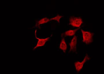 HSPB1 / HSP27 Antibody (phospho-Ser78)
