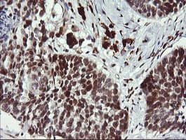 LMO2 Antibody (clone OTI1C8)