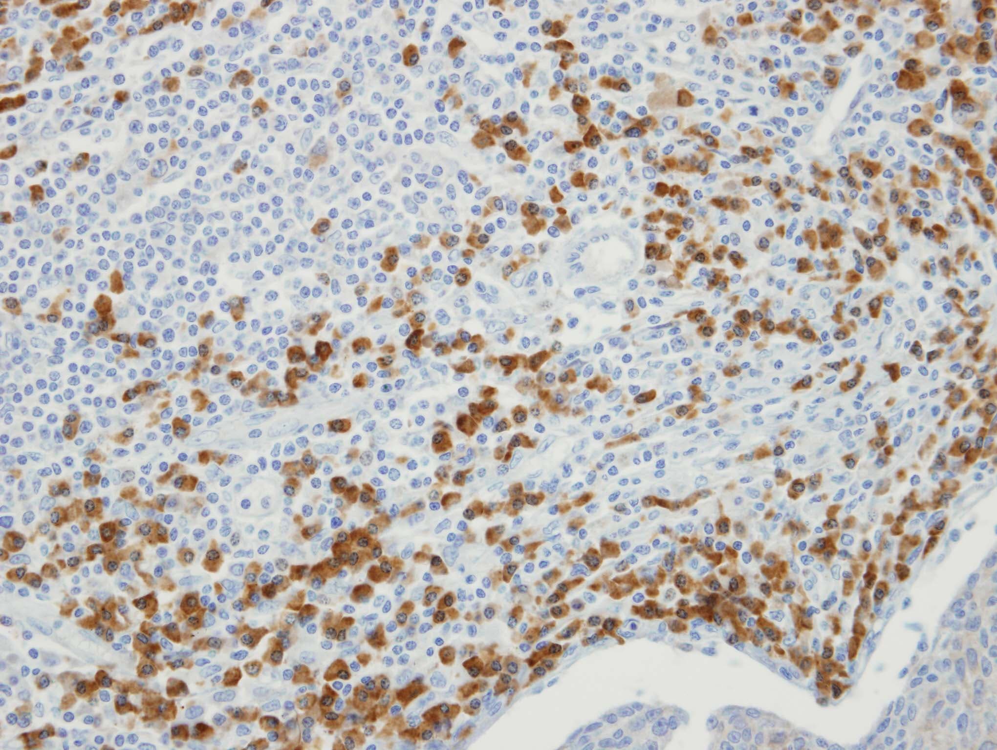 Polyclonal Rabbit anti-Human MTMR9 Antibody (aa487-549, IHC, WB)