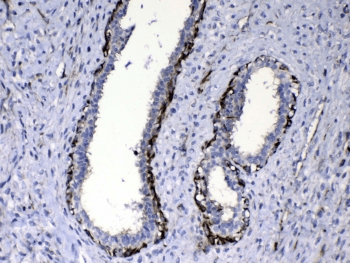 CCN3 / NOV Antibody