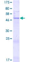 Human R3HDML Protein (Recombinant GST)