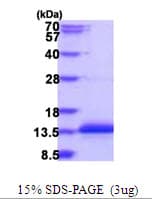 Human SVBP Protein (Recombinant His)