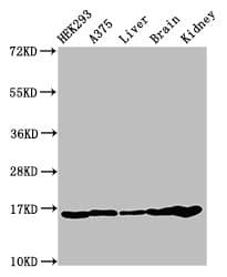 Polyclonal Rabbit anti-Human HIST1H3A Antibody (IHC, IF, WB)