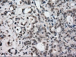 Monoclonal Mouse anti-Human STK39 / SPAK Antibody (clone OTI2E10, IHC, WB)