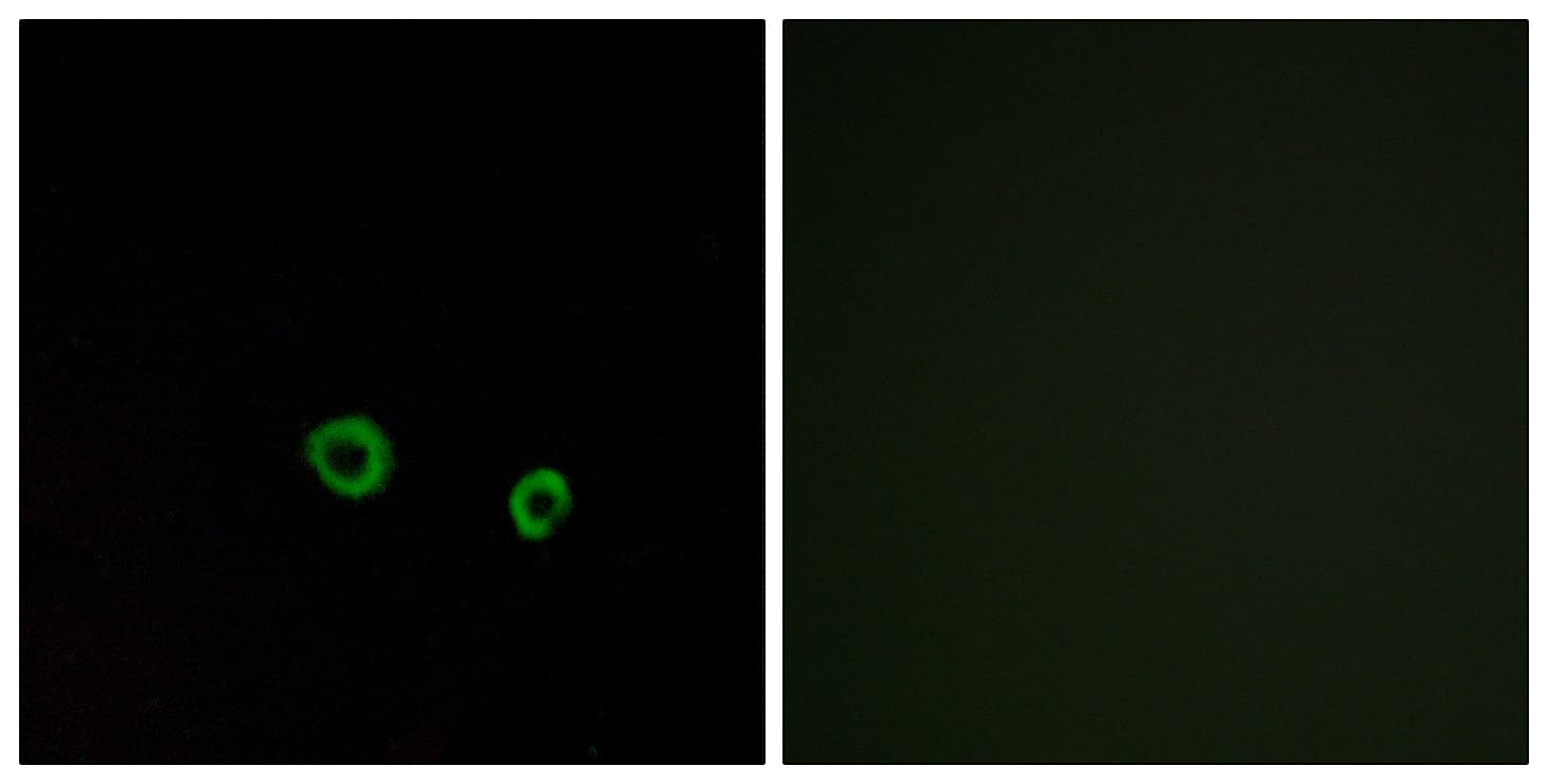 TAS2R10 / TRB2 Antibody (aa122-171)