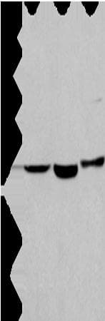 APMAP / C20orf3 Antibody