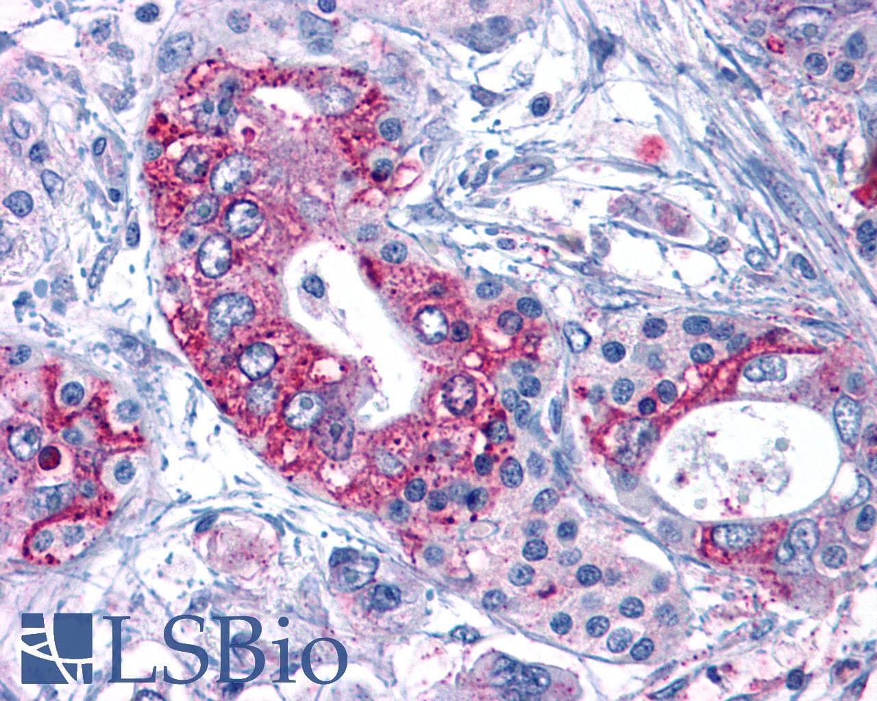 IHC-plus™ ACKR3 / CXCR7 Antibody