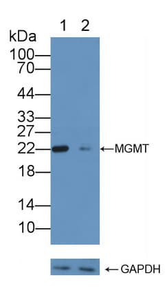 Polyclonal Rabbit anti-Human MGMT Antibody (aa1-207, WB)