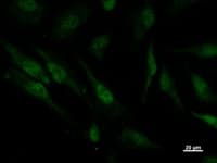 PSMC5 / SUG1 Antibody (clone 2837C4a)