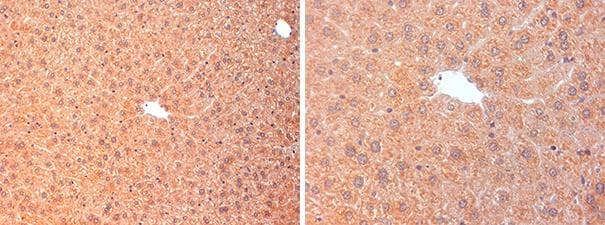 CFI / Complement Factor I Antibody