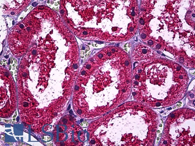 IHC-plus™ SPP1 / Osteopontin Antibody (clone X1)