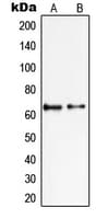 PIAS2 / PIASX Antibody (N-Terminus)