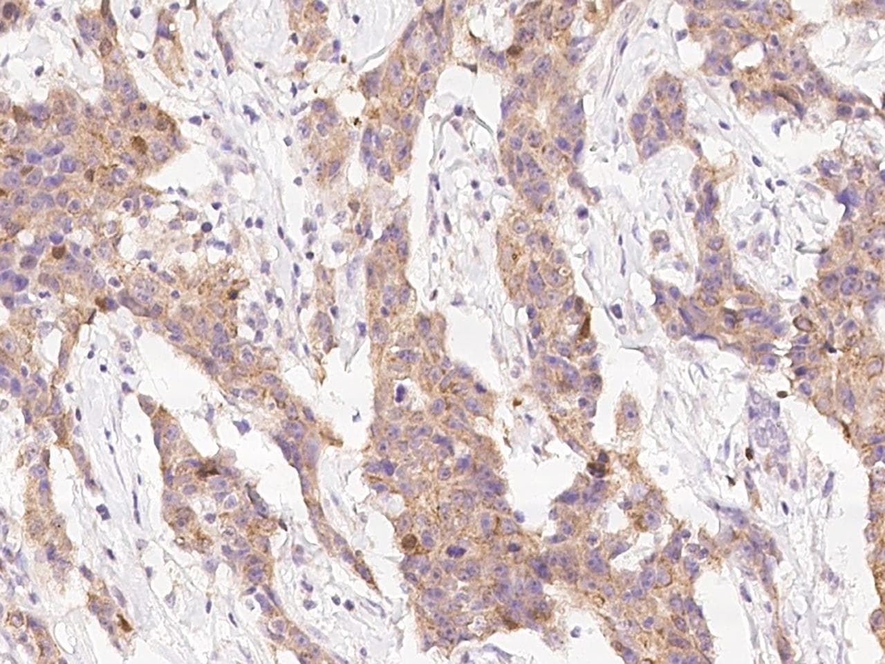 PPM1A / PP2CA Antibody (Preservative Free)
