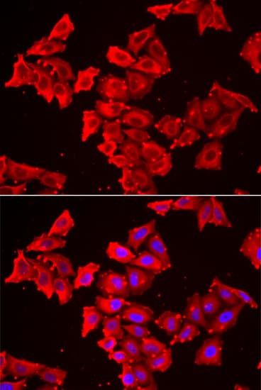 SMPX Antibody