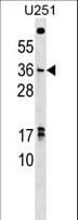 NKX3-1 Antibody (aa159-187)