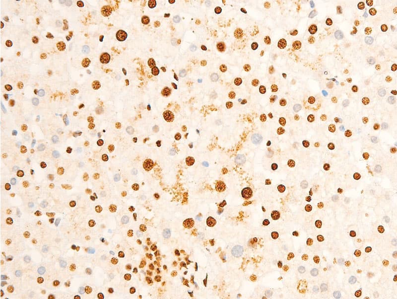 Polyclonal Rabbit anti-Human EIF2S1 Antibody (phospho-Ser51, IHC, IF, WB)