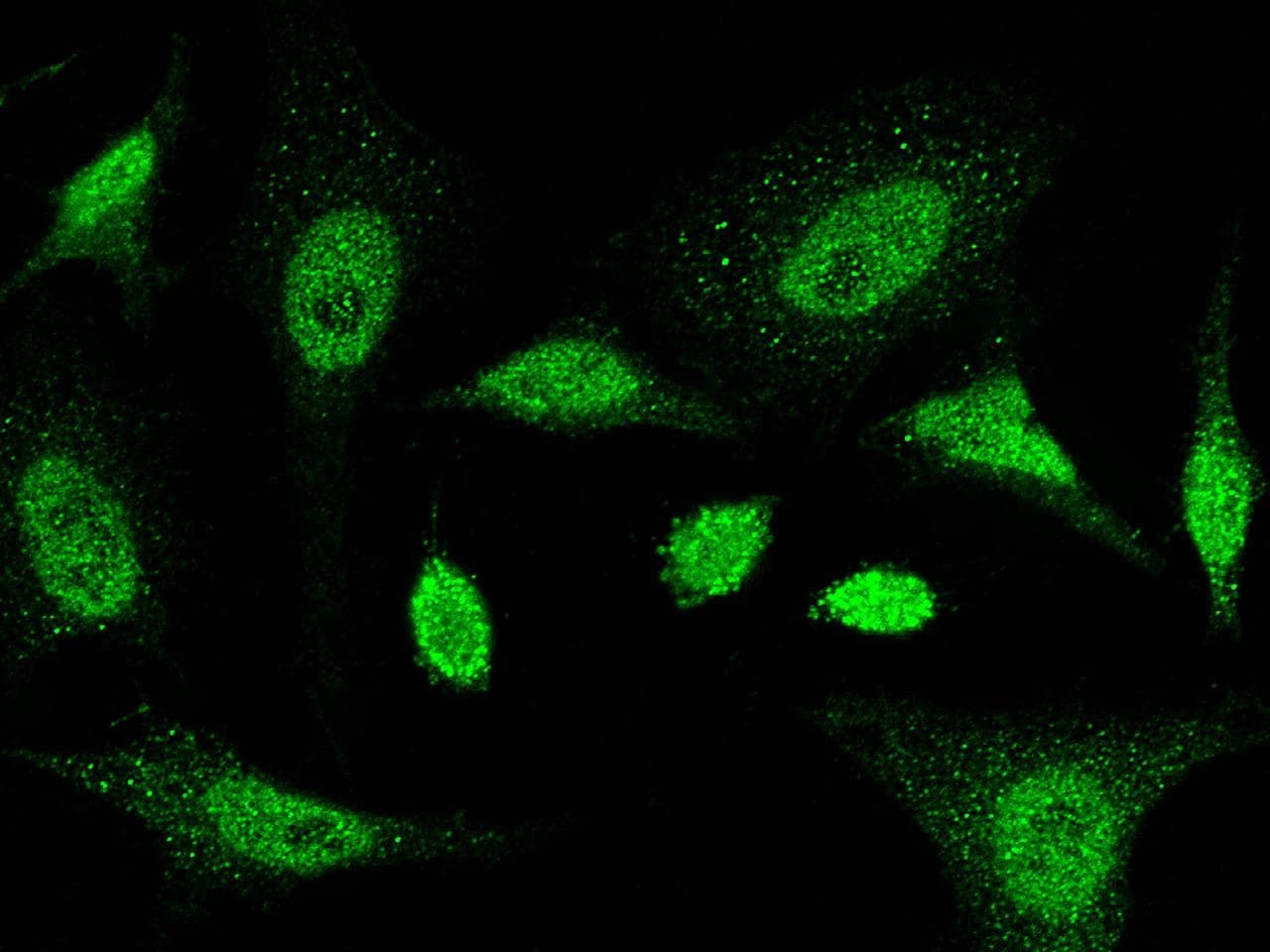 Polyclonal Rabbit anti-Human SMAD5 Antibody (Preservative Free, IHC, IF, WB)