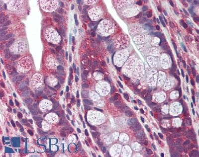 IHC-plus™ Polyclonal Rabbit anti-Human VIPERIN / RSAD2 Antibody (IHC, IF, WB)