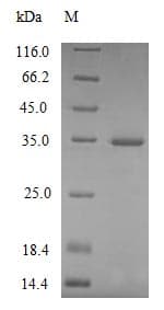 Mouse Complement C1QA Protein (Recombinant 6His, N-terminus)