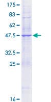 Human KDELR1 / HDEL Protein (Recombinant GST)