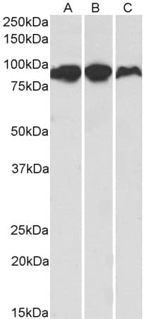IHC-plus™ Polyclonal Goat anti-Human ACO2 / Aconitase 2 Antibody (aa541-555, IHC, WB)