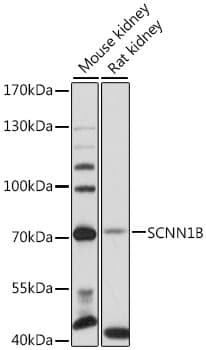 SCNN1B / ENaC Beta Antibody