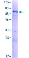 Human DHRS13 Protein (Recombinant GST)