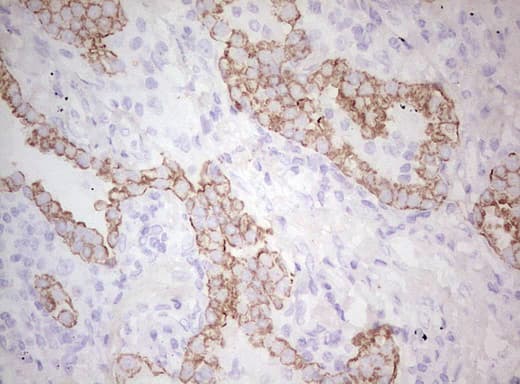 Monoclonal Mouse anti-Human Basic Cytokeratin AE3 Antibody (clone AE3, Carrier-free, IHC)
