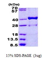 Human HSD17 / HSD17B1 Protein (Recombinant His)