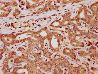 Polyclonal Rabbit anti-Human QPRT Antibody (IHC, IF)