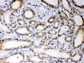 EBAG9 / RCAS1 Antibody